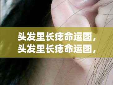 头发里长痣命运图解析，痣的位置预示未来运势走向